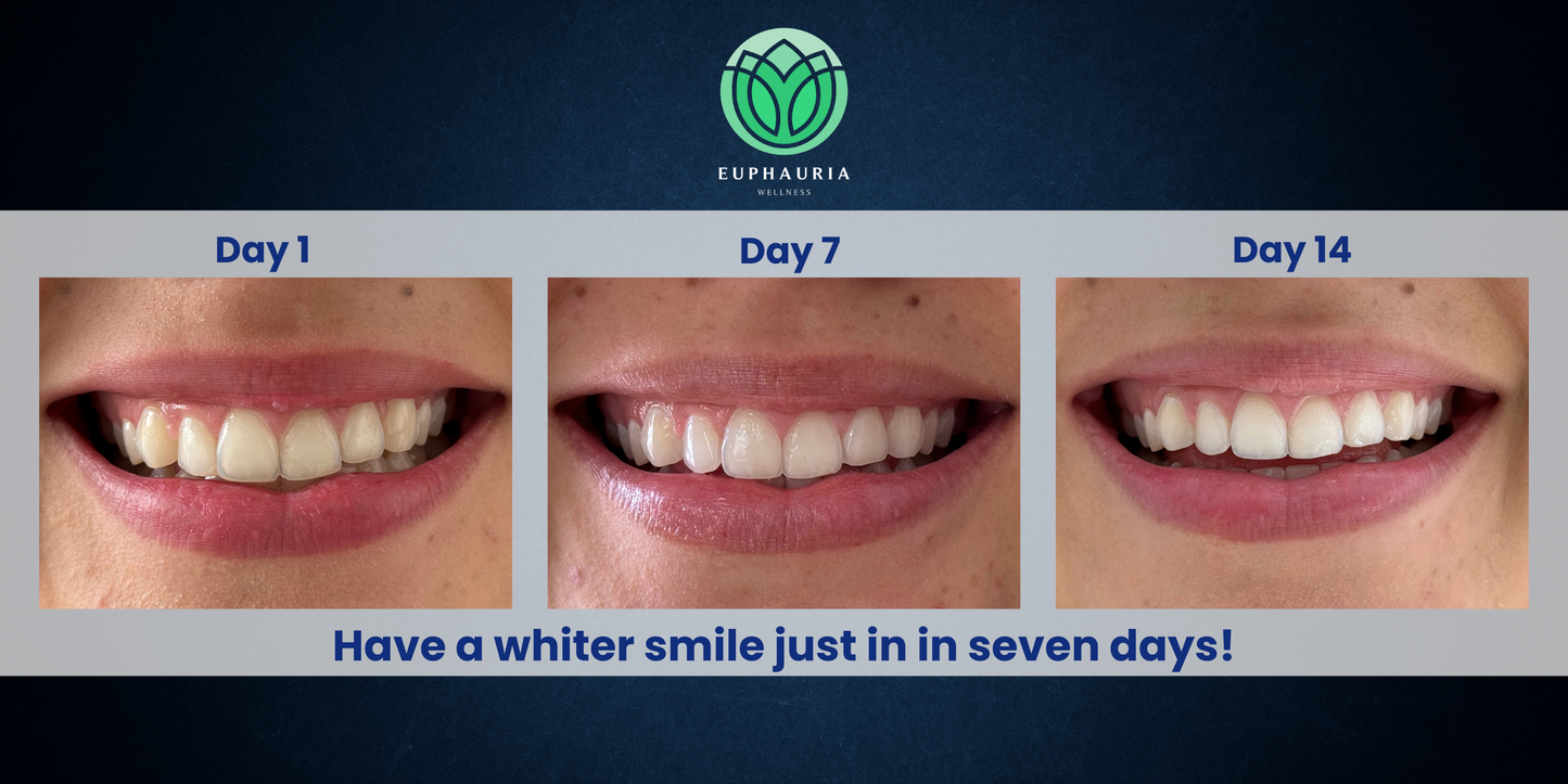 Euphauria Refill Pen for Teeth Whitening Kit - Extend Your Brighter Smile